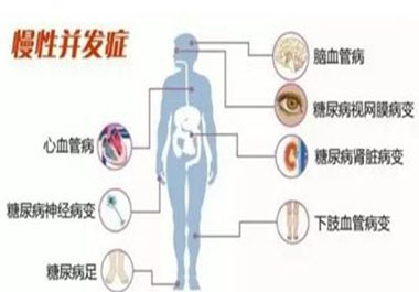 預防糖尿病并發(fā)癥記住一點穩(wěn)定血糖