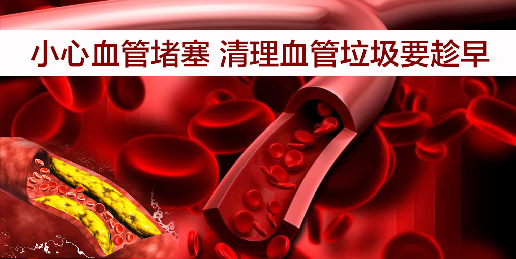 當(dāng)心！這幾類人群血管最易堵，適當(dāng)補(bǔ)硒遠(yuǎn)離血管疾病