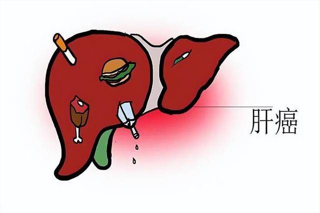 你知道嗎 肝癌都是拖出來(lái)的