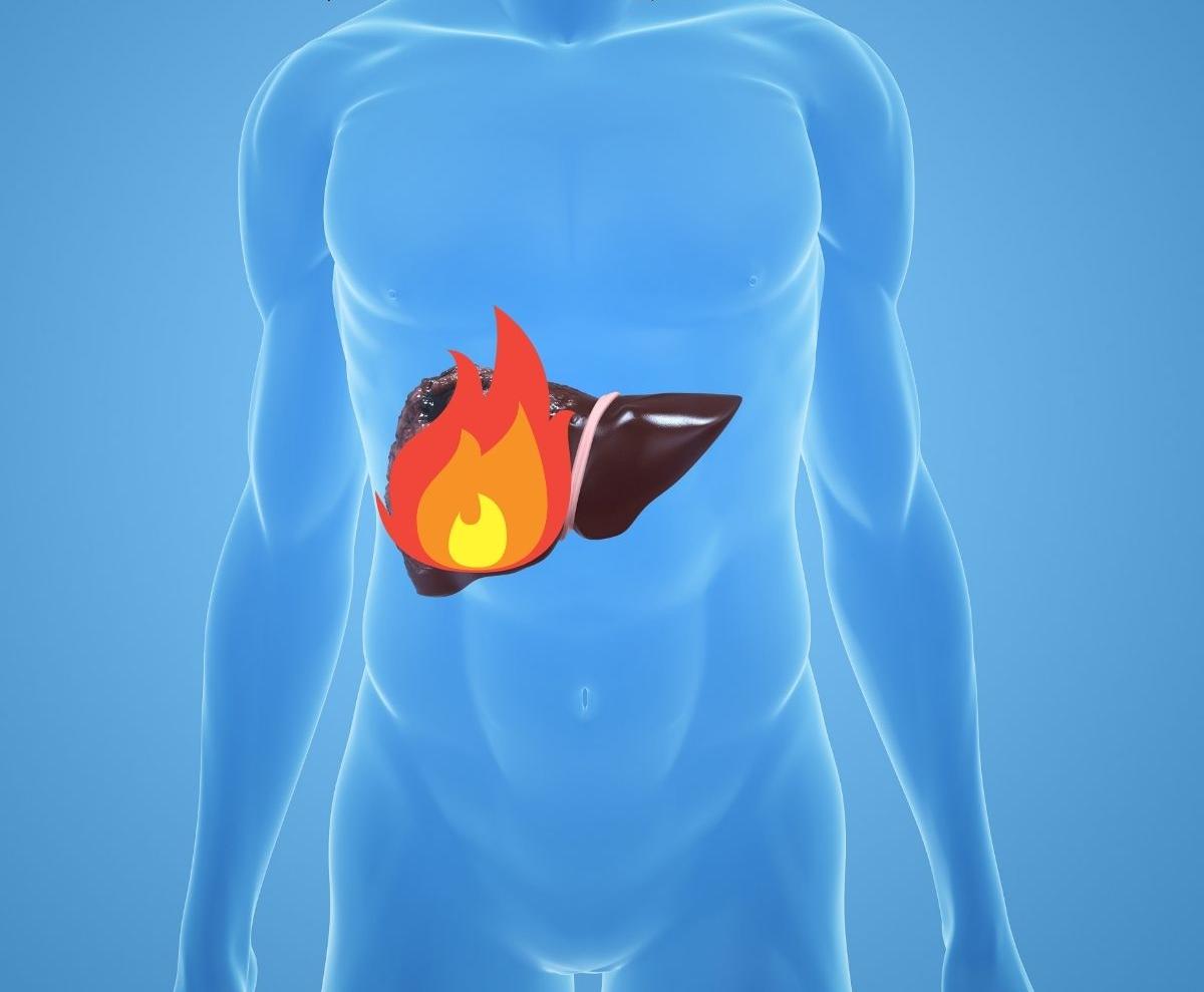 肝火旺怎么辦？